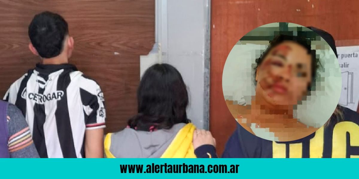 Pareja de motochorros tras violento asalto que dejó a una joven en Terapia Intensiva