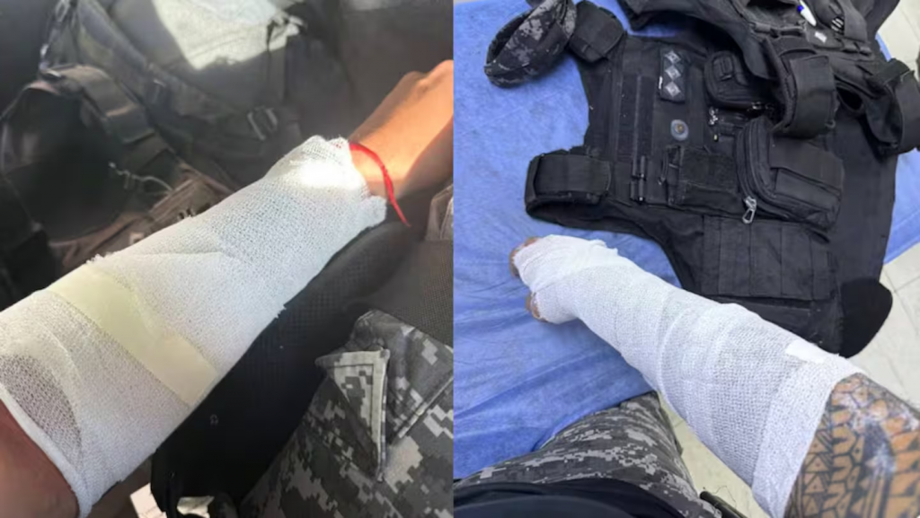 Córdoba: atacó a su mamá y quemó con agua caliente a dos policías