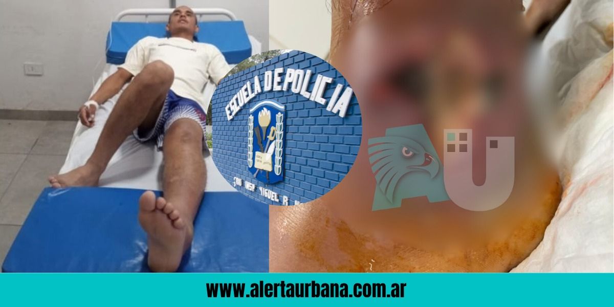 “Se le pudrió el tobillo y tenía gusanos”: alumno de la Escuela de Policía se esguinzó, tuvo complicaciones y ahora le piden la baja