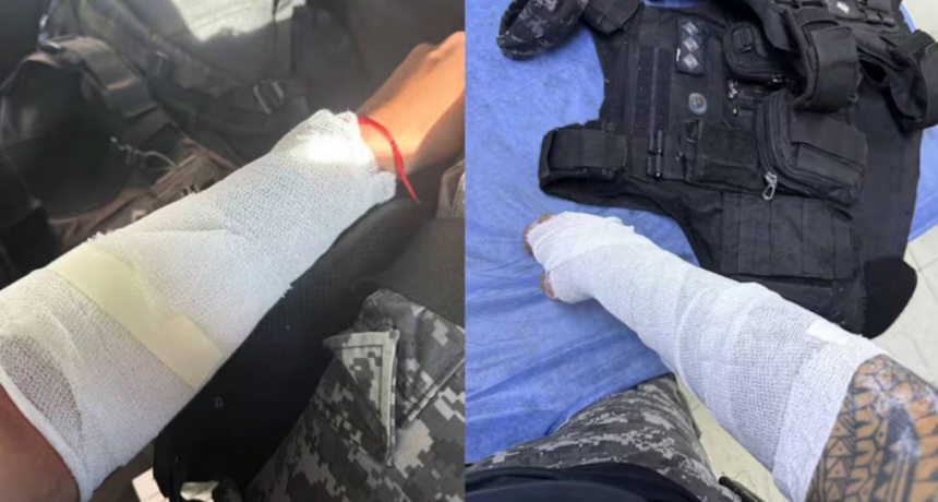 Córdoba: atacó a su mamá y quemó con agua caliente a dos policías