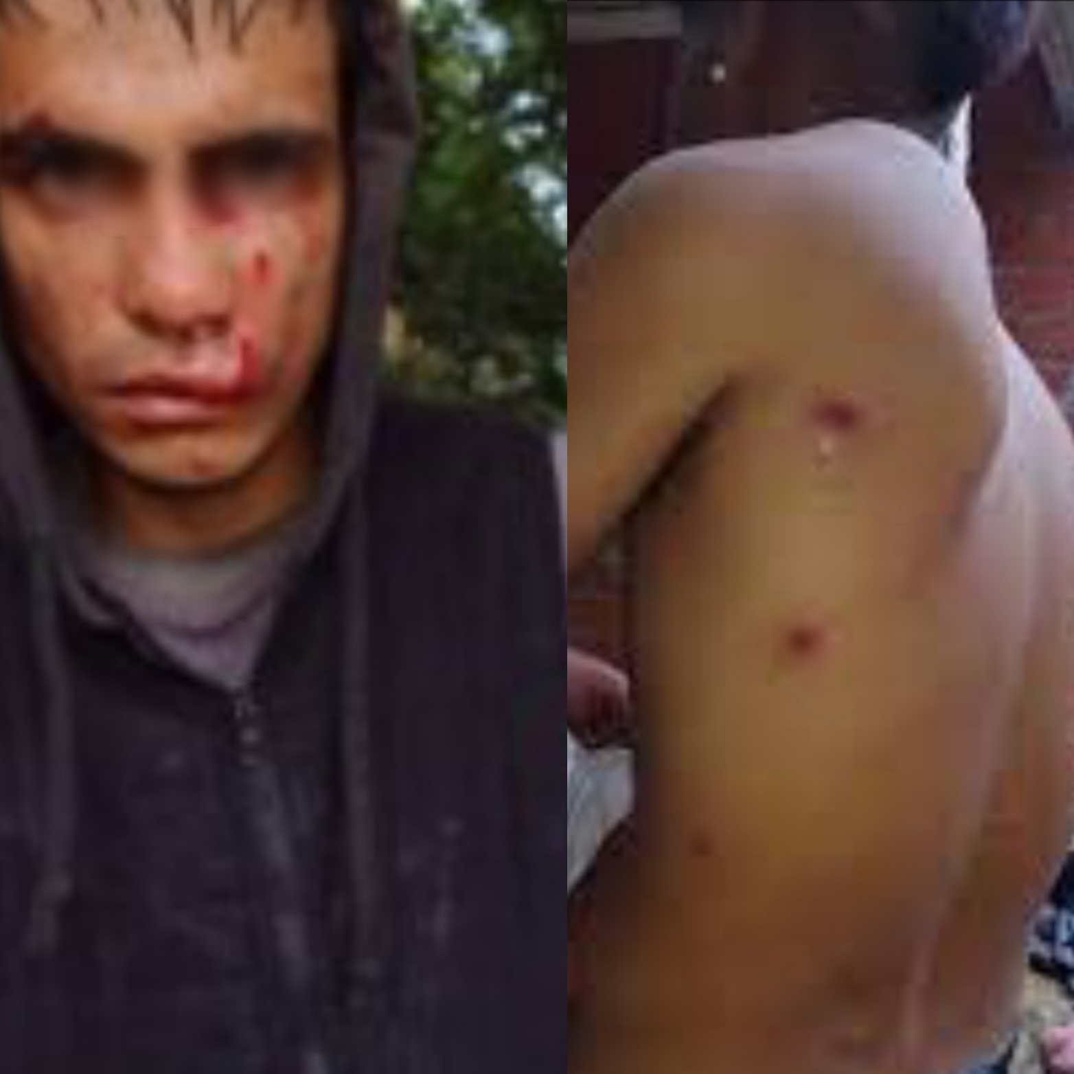Denuncian violencia policial en Loma Verde: 11 adolescentes heridos