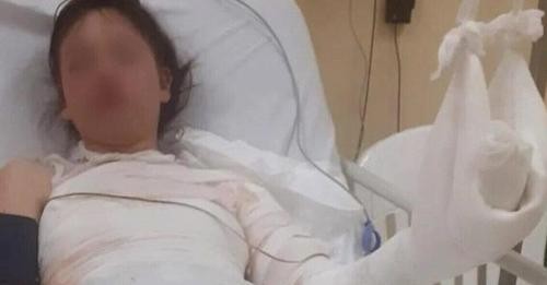 Una adolescente quedó internada tras un accidente en una clase de química