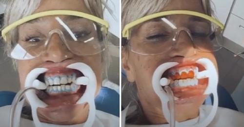 Florencia Peña se prepara para su boda con un tratamiento dental