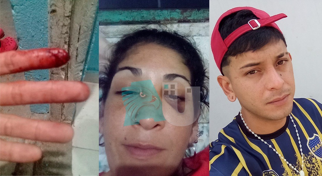 Súplica de una mujer: su ex casi la mata a cuchillazos y además denuncia que le robó $600.000